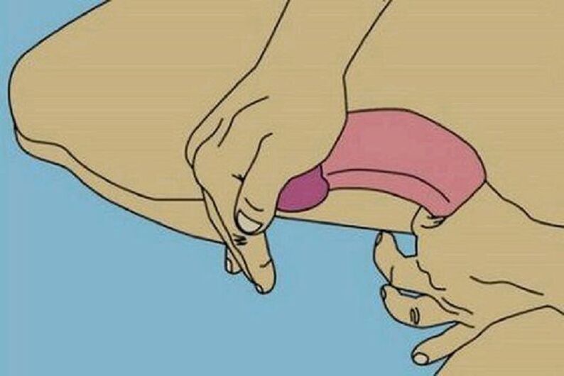 Flexibility to enlarge the penis