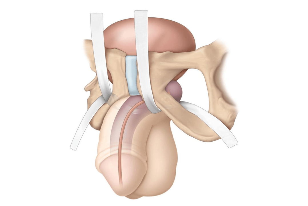 Areas examined for the presence of filler