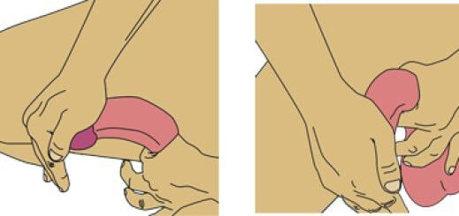 Bending the penis for enlargement