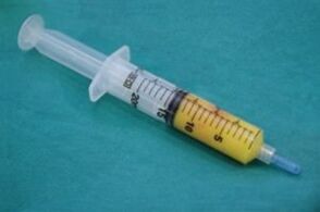 Syringe with fatty tissue to enlarge the penis