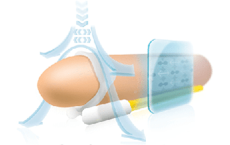 Principle of operation of the extension for stretching the length of the phallus