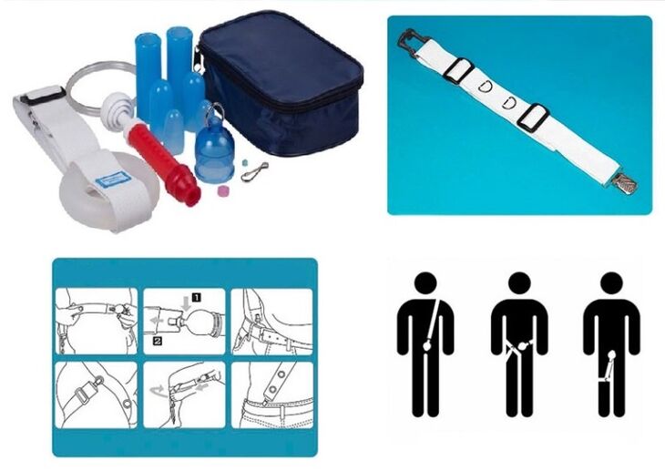 The penis can be lengthened and enlarged with a stretcher